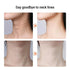 miqmi EMS Microcurrent Neck & Chin Lifting Device – LED Light, Vibration, Anti-Wrinkle Appearance