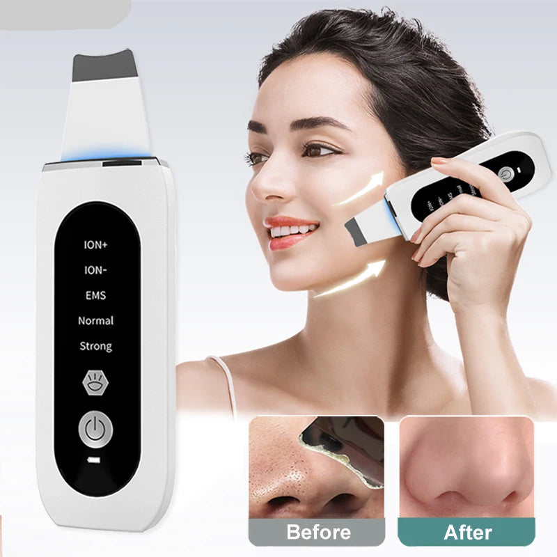 peicon Ultrasonic Skin Scrubber – Deep Face Cleaning, Blackhead Remover, EMS Ion Facial Spatula