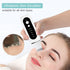 peicon Ultrasonic Skin Scrubber – Deep Face Cleaning, Blackhead Remover, EMS Ion Facial Spatula