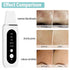 peicon Ultrasonic Skin Scrubber – Deep Face Cleaning, Blackhead Remover, EMS Ion Facial Spatula