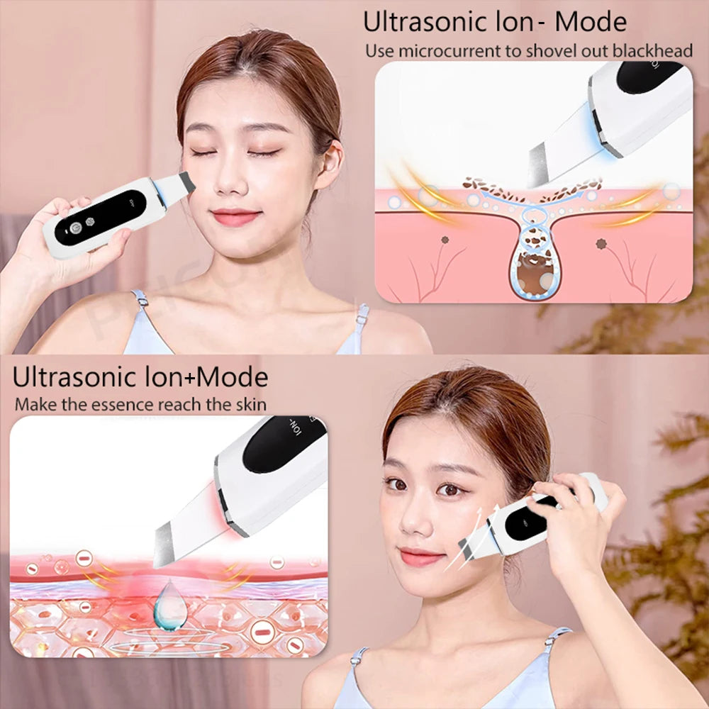 peicon Ultrasonic Skin Scrubber – Deep Face Cleaning, Blackhead Remover, EMS Ion Facial Spatula