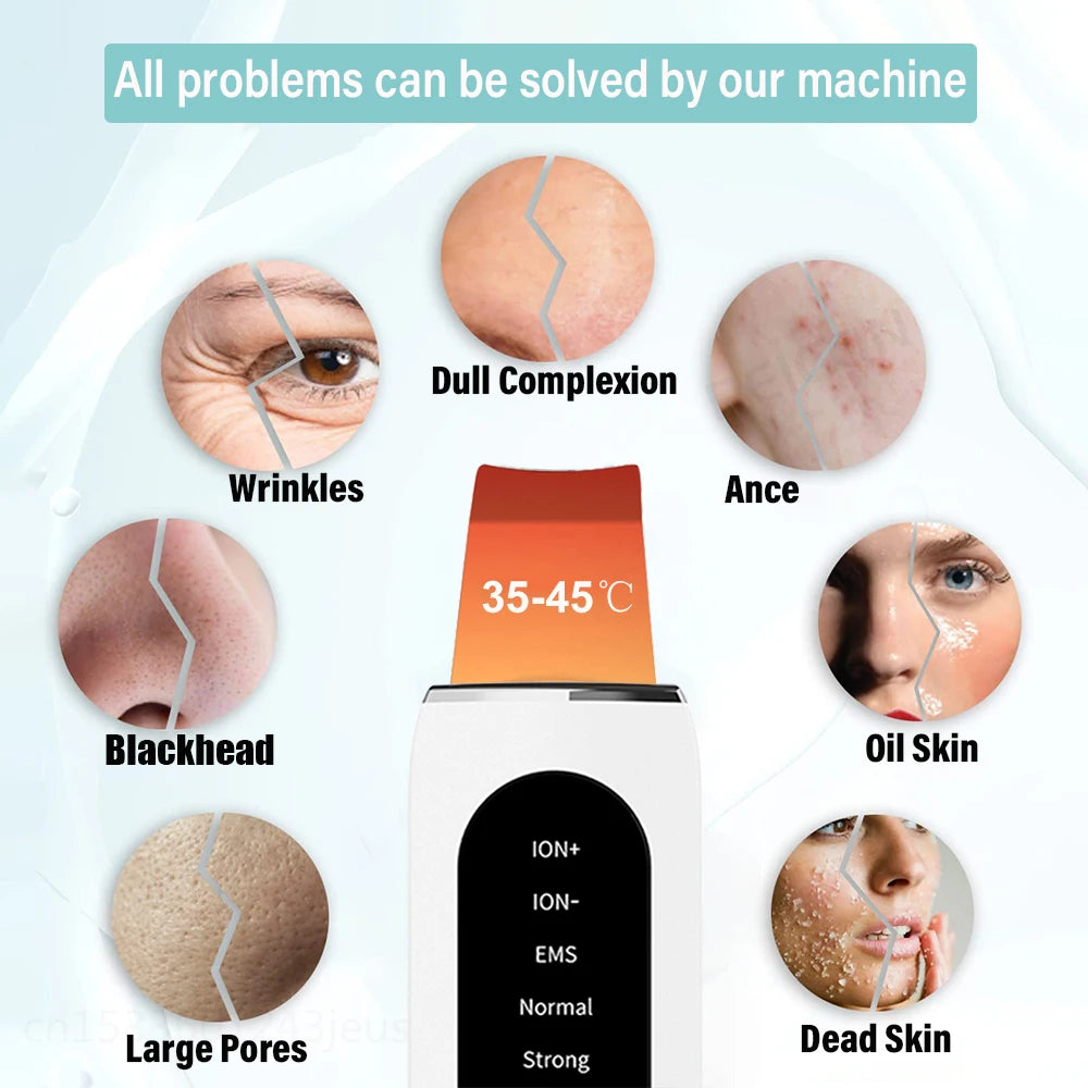 peicon Ultrasonic Skin Scrubber – Deep Face Cleaning, Blackhead Remover, EMS Ion Facial Spatula